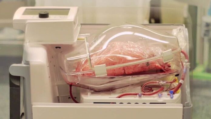 transplantation methodologies