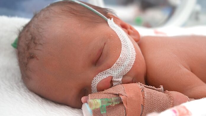 ბრონქოპულმონალური დისპლაზია