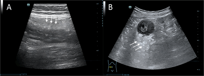 New non-invasive method