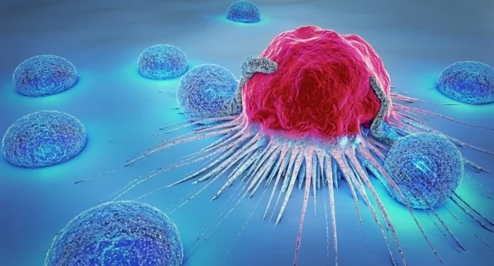 glioblastoma