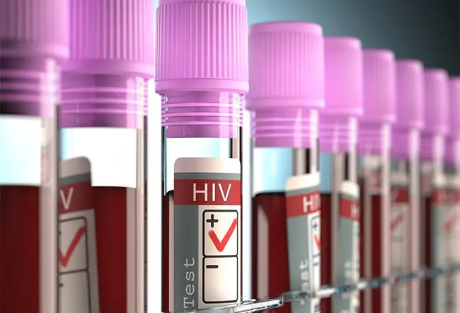 HIV