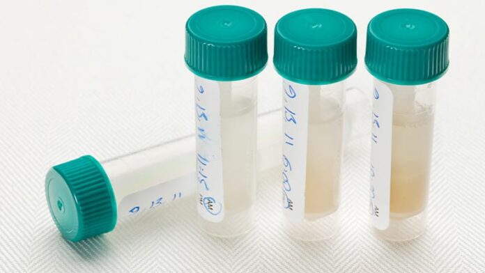 The Diagnostic Potential of Saliva and Urine in Rheumatology Clinical Practice