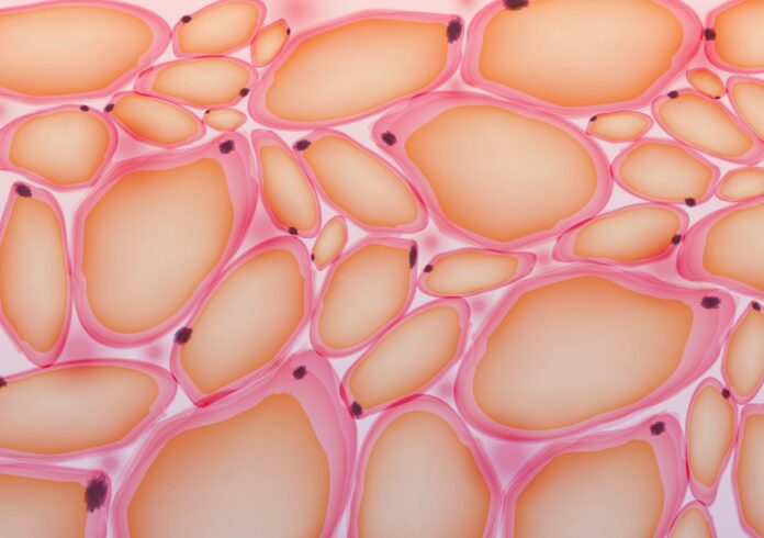 Not All Forms of Insulin Resistance Are Created Equal